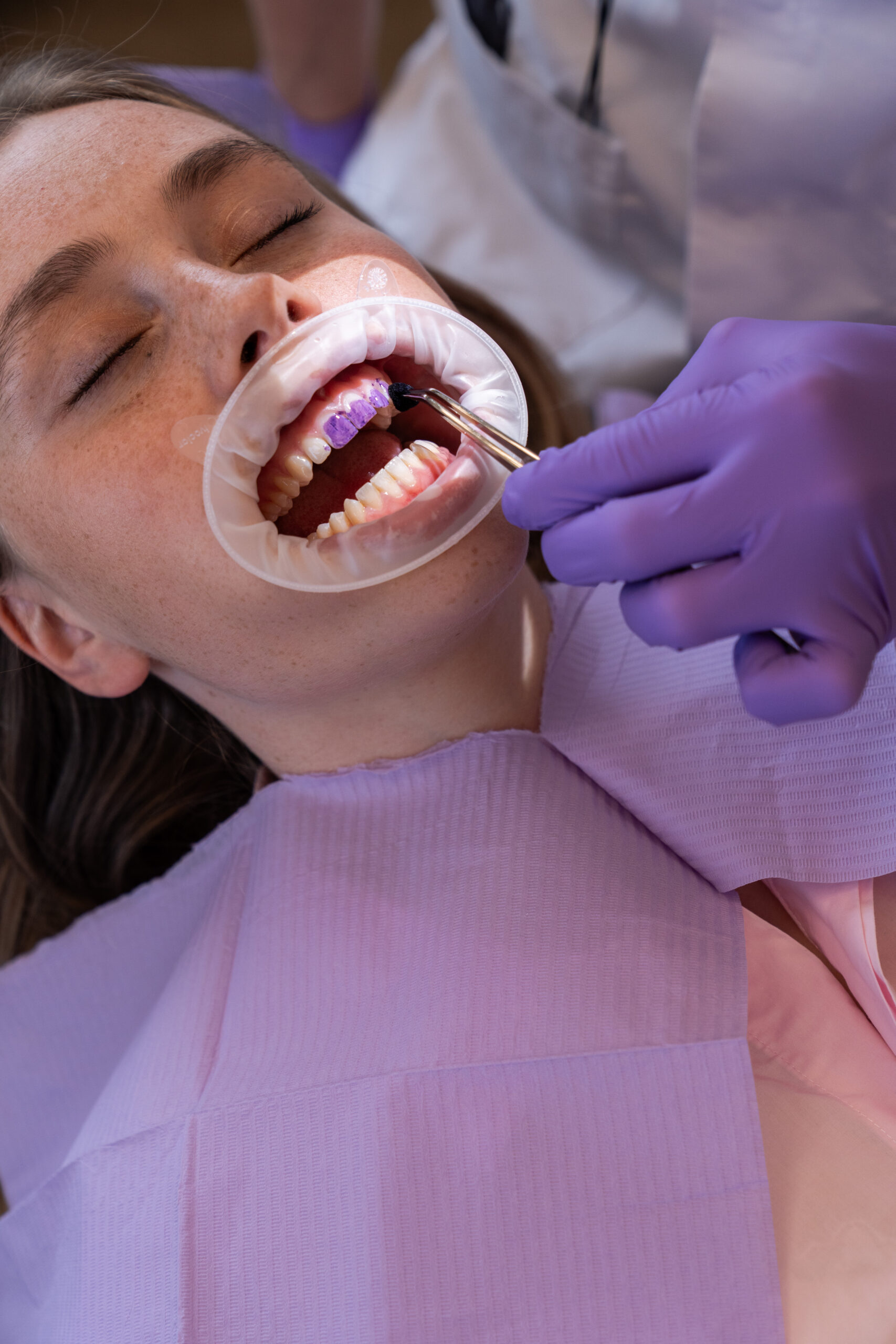 Social media voor een tandarts / mondhygiënist