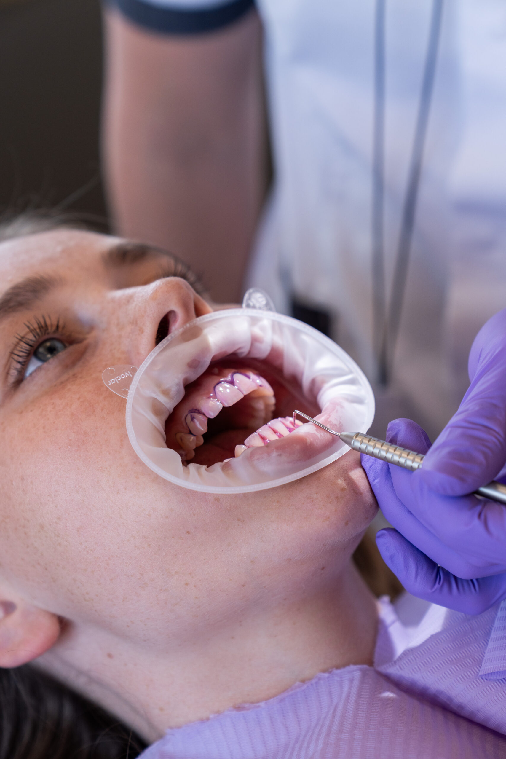 Social media voor een tandarts / mondhygiënist